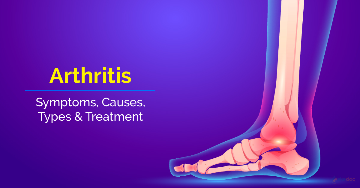 Arthritis: Symptoms, Causes, Types & Treatment