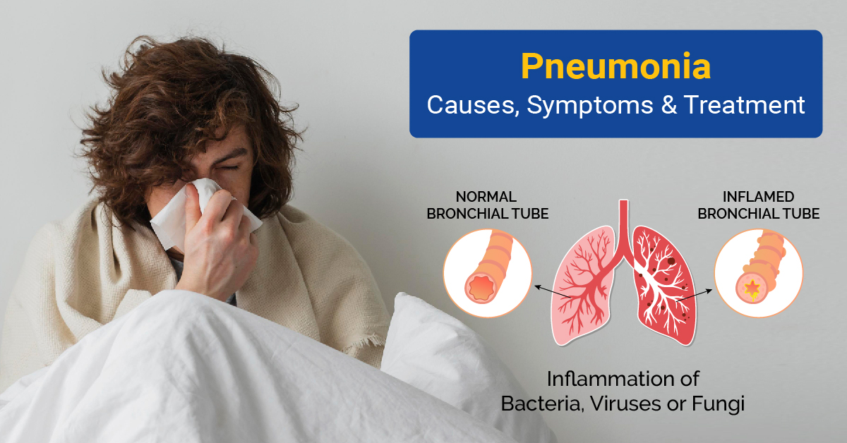 Pneumonia Symptoms and Diagnosis