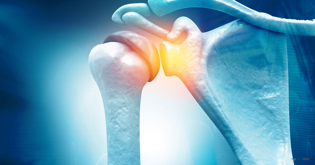 What Do You Need To Know About Shoulder Arthroscopy?