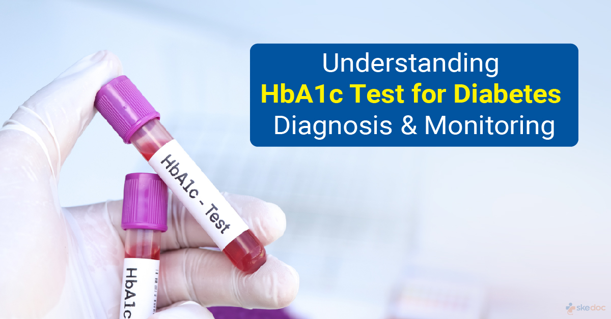 Understanding HbA1c Test For Diabetes Diagnosis And Monitoring