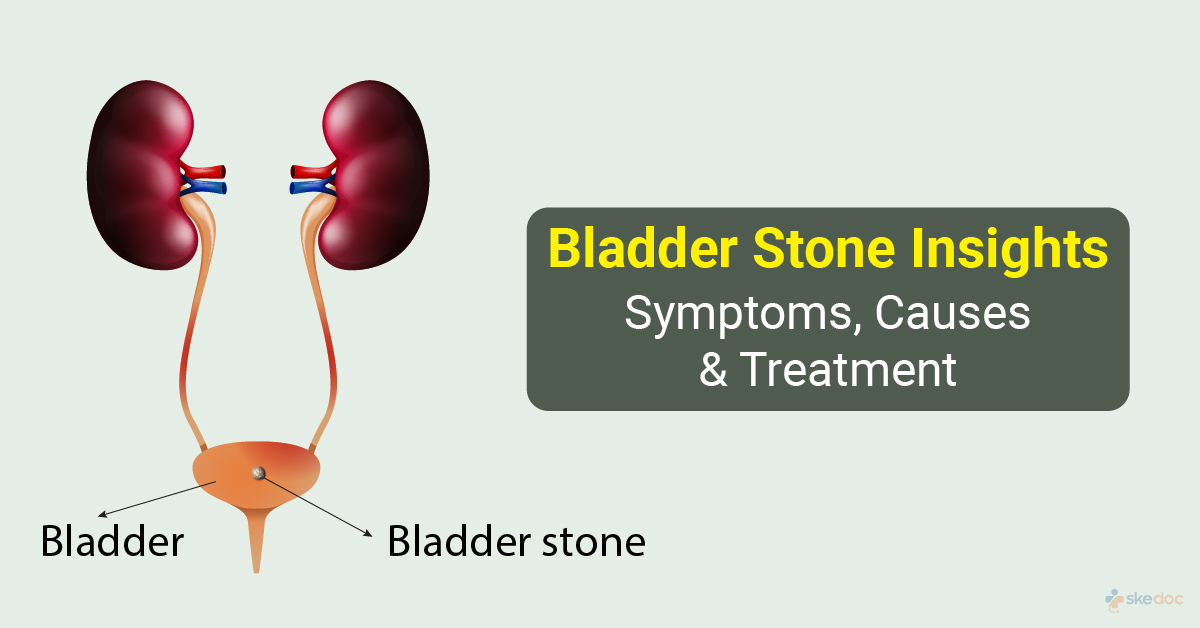 Bladder Stones