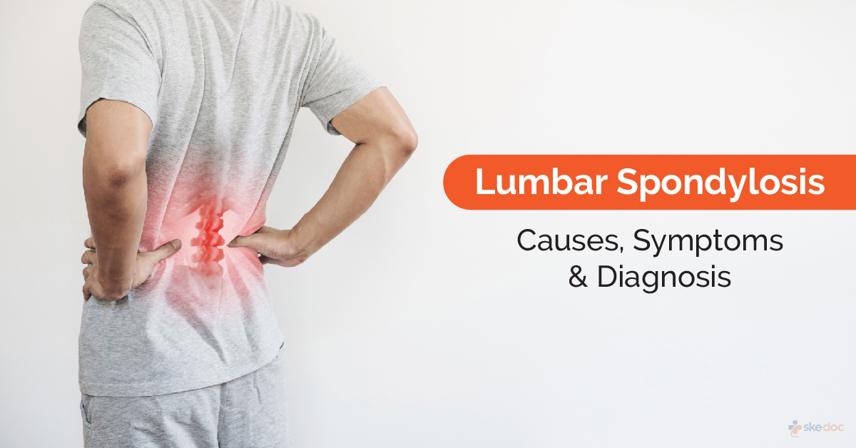 Lumbar Spondylosis-Causes, Symptoms, Diagnosis and Treatment