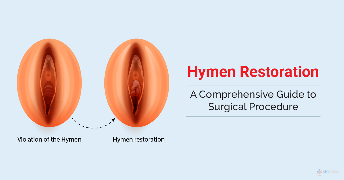 hymen reconstruction