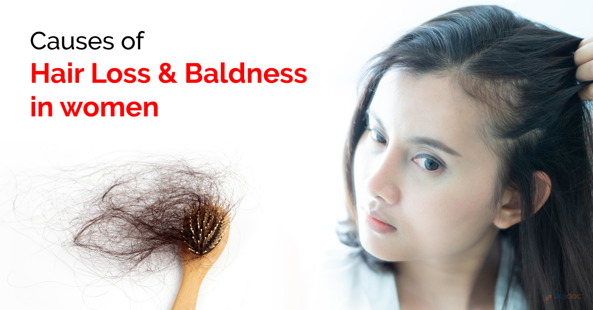 Causes of Hair Loss and Baldness in Women