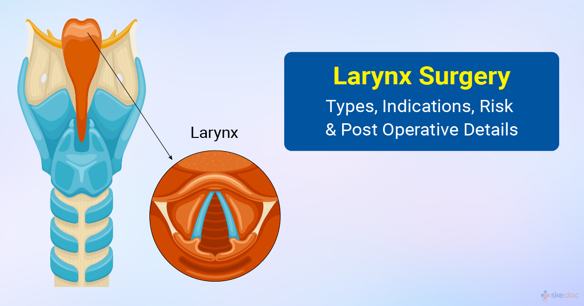 Larynx Surgeries
